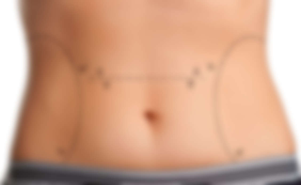 Dr. Benjamin Churchill on Free Plastic Surgery For Those in Need